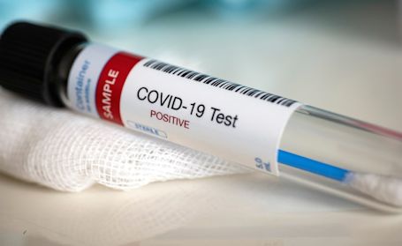 Grey-Bruce has five new cases of COVID-19; one in Kincardine